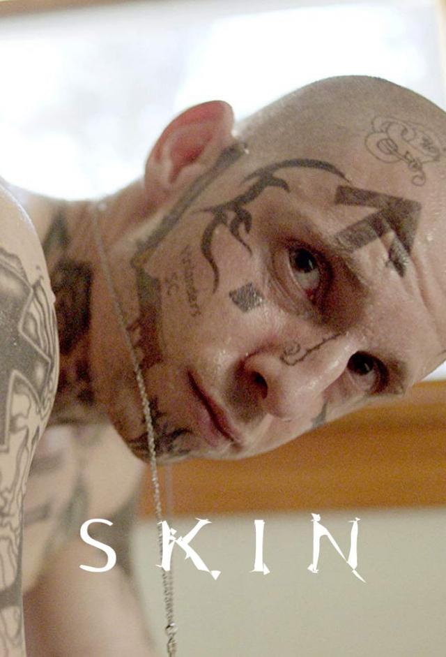 Skin