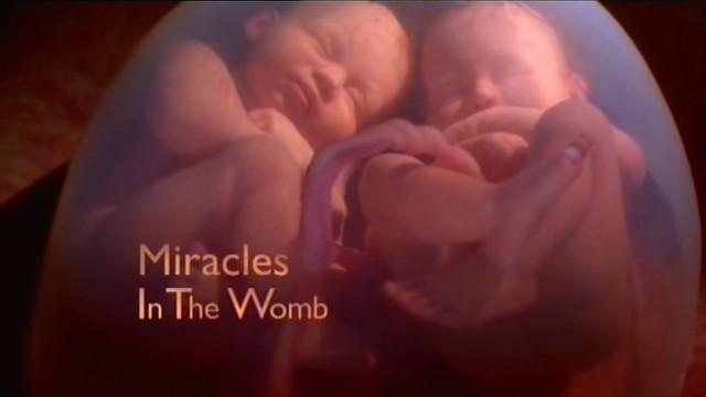 Miracles In The Womb