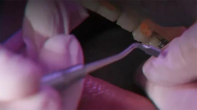 TQVSQSMTVDP: Dentist (SciCast #471)