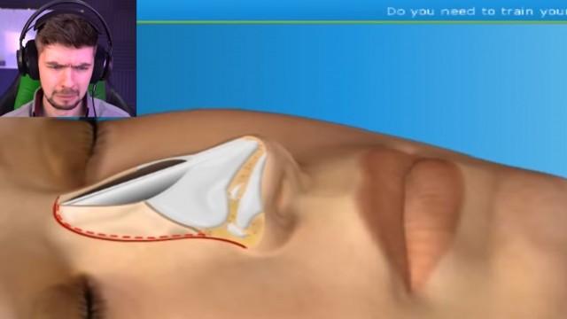 BREAKING NOSES FOR SCIENCE | Nose, Tattoo Removal Surgery