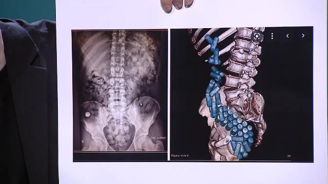 Urgencias. Entre la vida y la muerte: La mula – La pieza que falta: nanotecnología en la prehistoria – Cafés con el diablo – El gigante de Magarelos