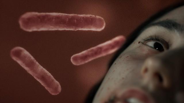 Chasing the Plague